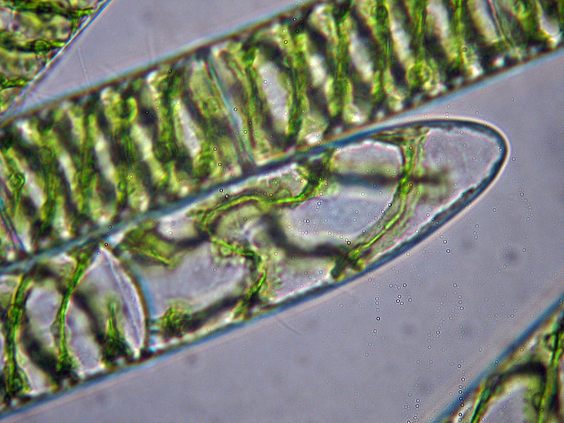 Dove finisce la Spirogyra...